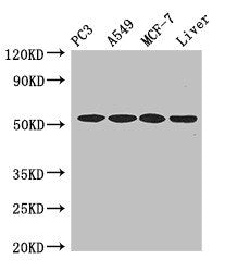 Western Blot Positive WB detected in: PC-3 whole cell lysate, A549 whole cell lysate, MCF-7 whole cell lysate, , Mouse liver tissue All lanes: IRF6 antibody at 4ug/ml Secondary Goat polyclonal to rabbit IgG at 1/50000 dilution Predicted band size:...