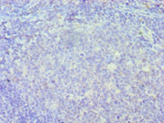 Immunohistochemistry of paraffin-embedded human tonsil tissue using CSB-PA011823ESR1HU at dilution of 1:100