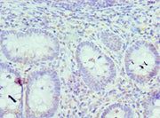 Immunohistochemistry of paraffin-embedded human epityphlon tissue using CSB-PA011823ESR2HU at dilution of 1:100