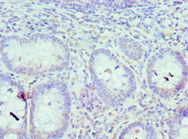 Immunohistochemistry of paraffin-embedded human epityphlon tissue using CSB-PA011823ESR2HU at dilution of 1:100