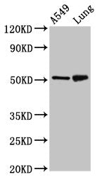 Western Blot Positive WB detected in: A549 whole cell lysate, Rat lung tissue All lanes: IRX3 antibody at 5ug/ml Secondary Goat polyclonal to rabbit IgG at 1/50000 dilution Predicted band size: 53 kDa Observed band size: 53 kDa