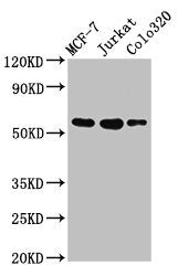 Western Blot Positive WB detected in: MCF-7 whole cell lysate, Jurkat whole cell lysate, Colo320 whole cell lysate All lanes: IRX4 antibody at 3µg/ml Secondary Goat polyclonal to rabbit IgG at 1/50000 dilution Predicted band size: 55, 58 kDa Obser...
