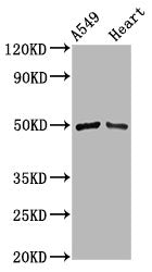 Western Blot Positive WB detected in: A549 whole cell lysate, Rat heart tissue All lanes: IRX6 antibody at 3.8µg/ml Secondary Goat polyclonal to rabbit IgG at 1/50000 dilution Predicted band size: 49 kDa Observed band size: 49 kDa