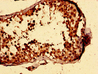 Immunohistochemistry of paraffin-embedded human testis tissue using CSB-PA011846LA01HU at dilution of 1:100