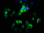 Immunofluorescence staining of MCF-7 cells with CSB-PA011864LA01HU at 1:200, counter-stained with DAPI. The cells were fixed in 4% formaldehyde, permeabilized using 0.2% Triton X-100 and blocked in 10% normal Goat Serum. The cells were then incuba...