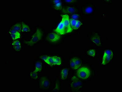 Immunofluorescence staining of MCF-7 cells with CSB-PA011864LA01HU at 1:200, counter-stained with DAPI. The cells were fixed in 4% formaldehyde, permeabilized using 0.2% Triton X-100 and blocked in 10% normal Goat Serum. The cells were then incuba...