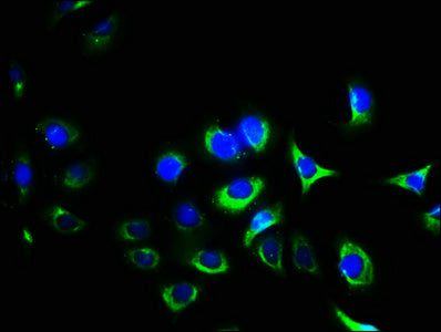 Immunofluorescence staining of A549 cells with CSB-PA011865LA01HU at 1:400, counter-stained with DAPI. The cells were fixed in 4% formaldehyde, permeabilized using 0.2% Triton X-100 and blocked in 10% normal Goat Serum. The cells were then incubat...