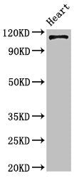 Western Blot Positive WB detected in: Mouse heart tissue All lanes: ITGA5 antibody at 4ug/ml Secondary Goat polyclonal to rabbit IgG at 1/50000 dilution Predicted band size: 115 kDa Observed band size: 115 kDa