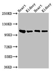 Western Blot Positive WB detected in: Rat heart tissue, Rat kidney tissue, Mouse heart tisseu, Mouse kidney tissue All lanes: ITGA6 antibody at 3ug/ml Secondary Goat polyclonal to rabbit IgG at 1/50000 dilution Predicted band size: 127, 120, 123,...