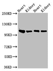 Western Blot Positive WB detected in: Rat heart tissue, Rat kidney tissue, Mouse heart tisseu, Mouse kidney tissue All lanes: ITGA6 antibody at 3ug/ml Secondary Goat polyclonal to rabbit IgG at 1/50000 dilution Predicted band size: 127, 120, 123,...