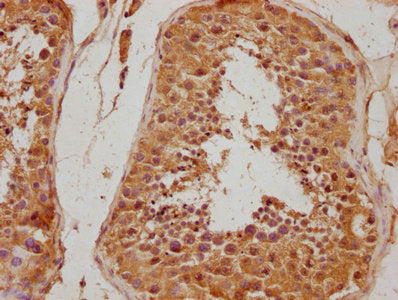IHC image of CSB-PA011871NA01HU diluted at 1:500 and staining in paraffin-embedded human testis tissue performed on a Leica BondTM system. After dewaxing and hydration, antigen retrieval was mediated by high pressure in a citrate buffer (pH 6.0)....