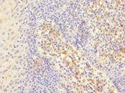 Immunohistochemistry of paraffin-embedded human tonsil tissue using CSB-PA011874ESR1HU at dilution of 1:100