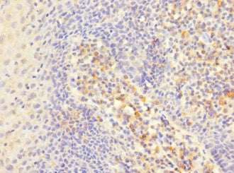 Immunohistochemistry of paraffin-embedded human tonsil tissue using CSB-PA011874ESR1HU at dilution of 1:100