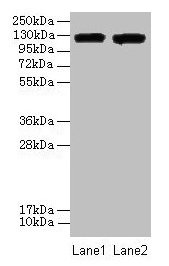 Western blot All lanes: ITGAL antibody at 8µg/ml Lane 1: A549 whole cell lysate Lane 2: HepG2 whole cell lysate Secondary Goat polyclonal to rabbit IgG at 1/10000 dilution Predicted band size: 129, 135, 120 kDa Observed band size: 129 kDa