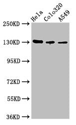Western Blot Positive WB detected in: Hela whole cell lysate, Colo320 whole cell lysate, A549 whole cell lysate All lanes: ITGAV antibody at 2.7µg/ml Secondary Goat polyclonal to rabbit IgG at 1/50000 dilution Predicted band size: 117, 113, 112 kD...