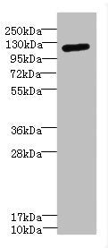 Western blot All lanes: ITGAXantibody IgG at 1.59ug/ml + Mouse kidney tissue Secondary Goat polyclonal to rabbit IgG at 1/10000 dilution Predicted band size: 128 kDa Observed band size: 128 kDa