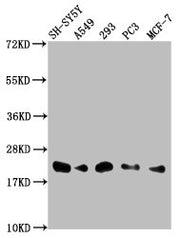 Western Blot Positive WB detected in: SH-SY5Y whole cell lysate, A549 whole cell lysate, 293 whole cell lysate, PC-3 whole cell lysate, MCF-7 whole cell lysate All lanes: ITGB1BP1 antibody at 1:2000 Secondary Goat polyclonal to rabbit IgG at 1/500...
