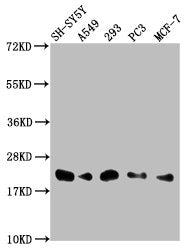 Western Blot Positive WB detected in: SH-SY5Y whole cell lysate, A549 whole cell lysate, 293 whole cell lysate, PC-3 whole cell lysate, MCF-7 whole cell lysate All lanes: ITGB1BP1 antibody at 1:2000 Secondary Goat polyclonal to rabbit IgG at 1/500...