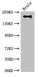 Western Blot Positive WB detected in: Mouse brain tissue All lanes: ITGB4 antibody at 3.5ug/ml Secondary Goat polyclonal to rabbit IgG at 1/50000 dilution Predicted band size: 203, 196, 201, 195, 107 kDa Observed band size: 203 kDa