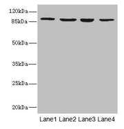 Western blot All lanes: ITGB7 antibody at 5.04ug/ml Lane 1: MCF-7 whole cell lysate Lane 2: HepG2 whole cell lysate Lane 3: A549 whole cell lysate Lane 4: K562 whole cell lysate Secondary Goat polyclonal to rabbit IgG at 1/10000 dilution Predicted...