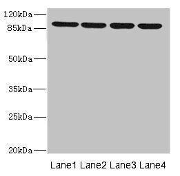 Western blot All lanes: ITGB8 antibody at 1.52µg/ml Lane 1: 293T whole cell lysate Lane 2: Hela whole cell lysate Lane 3: HepG2 whole cell lysate Lane 4: A549 whole cell lysate Secondary Goat polyclonal to rabbit IgG at 1/10000 dilution Predicted...