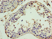 Immunohistochemistry of paraffin-embedded human testis tissue using CSB-PA011897YA01HU at dilution of 1:100