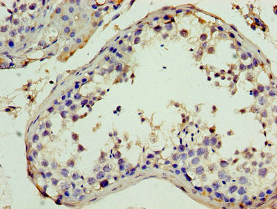 Immunohistochemistry of paraffin-embedded human testis tissue using CSB-PA011897YA01HU at dilution of 1:100