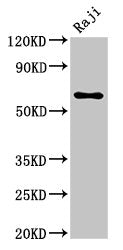 Western Blot Positive WB detected in: Raji whole cell lysate All lanes: MSN antibody at 5.7ug/ml Secondary Goat polyclonal to rabbit IgG at 1/50000 dilution Predicted band size: 68 kDa Observed band size: 68 kDa