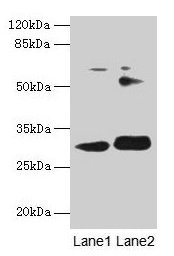 Western blot All lanes: ITM2A antibody at 0.3µg/ml Lane 1: HL60 whole cell lysate Lane 2: SH-SY5Y whole cell lysate Secondary Goat polyclonal to rabbit IgG at 1/10000 dilution Predicted band size: 30, 25 kDa Observed band size: 30 kDa
