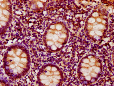 IHC image of CSB-PA011921LA01HU diluted at 1:500 and staining in paraffin-embedded human appendix tissue performed on a Leica BondTM system. After dewaxing and hydration, antigen retrieval was mediated by high pressure in a citrate buffer (pH 6.0)...