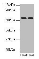 Western blot All lanes: IMPDH2 antibody at 2µg/ml Lane 1: EC109 whole cell lysate Lane 2: 293T whole cell lysate Secondary Goat polyclonal to rabbit IgG at 1/15000 dilution Predicted band size: 56 kDa Observed band size: 56 kDa