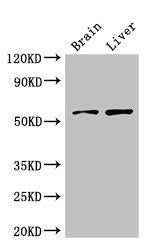 Western Blot Positive WB detected in: Mouse brain tissue, Rat liver tissue All lanes: KCNA1 antibody at 3ug/ml Secondary Goat polyclonal to rabbit IgG at 1/50000 dilution Predicted band size: 57 kDa Observed band size: 57 kDa