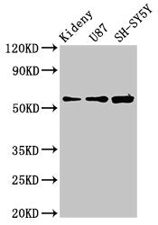 Western Blot Positive WB detected in: Mouse kidney tissue, U87 whole cell lysate, SH-SY5Y whole cell lysate All lanes: KCNAB1 antibody at 3.9µg/ml Secondary Goat polyclonal to rabbit IgG at 1/50000 dilution Predicted band size: 47, 45, 46 kDa Obse...