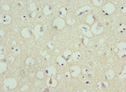 Immunohistochemistry of paraffin-embedded human brain tissue using CSB-PA012035DSR1HU at dilution of 1:100