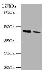 Western blot All lanes: KCNJ1 antibody at 2µg/ml Lane 1: HepG2 whole cell lysate Lane 2: Hela whole cell lysate Secondary Goat polyclonal to rabbit IgG at 1/10000 dilution Predicted band size: 45, 43 kDa Observed band size: 45 kDa
