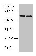 Western blot All lanes: IFITM1 antibody at 2µg/ml Lane 1: EC109 whole cell lysate Lane 2: 293T whole cell lysate Secondary Goat polyclonal to rabbit IgG at 1/15000 dilution Predicted band size: 14 kDa Observed band size: 70 kDa