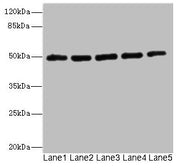 Western blot All lanes: KCNJ4 antibody at 2.04µg/ml Lane 1: Hela whole cell lysate Lane 2: 293T whole cell lysate Lane 3: HepG2 whole cell lysate Lane 4: Jurkat whole cell lysate Lane 5: MCF-7 whole cell lysate Secondary Goat polyclonal to rabbit...
