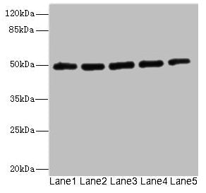 Western blot All lanes: KCNJ4 antibody at 2.04µg/ml Lane 1: Hela whole cell lysate Lane 2: 293T whole cell lysate Lane 3: HepG2 whole cell lysate Lane 4: Jurkat whole cell lysate Lane 5: MCF-7 whole cell lysate Secondary Goat polyclonal to rabbit...