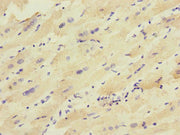 Immunohistochemistry of paraffin-embedded human heart tissue using CSB-PA012057ESR2HU at dilution of 1:100