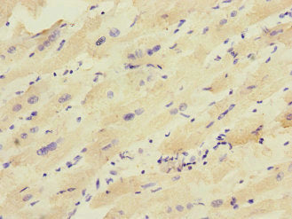 Immunohistochemistry of paraffin-embedded human heart tissue using CSB-PA012057ESR2HU at dilution of 1:100