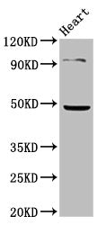 Western Blot Positive WB detected in: Mouse heart tissue All lanes: KCNJ5 antibody at 4.85ug/ml Secondary Goat polyclonal to rabbit IgG at 1/50000 dilution Predicted band size: 48 kDa Observed band size: 48 kDa