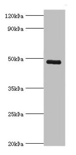 Western blot All lanes: KCNN4 antibody at 8µg/ml + human serum Secondary Goat polyclonal to rabbit IgG at 1/10000 dilution Predicted band size: 48 kDa Observed band size: 48 kDa