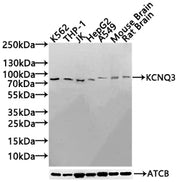 Western Blot Positive WB detected in: K562 whole cell lysate(30µg), THP-1 whole cell lysate(30µg), JK whole cell lysate(30µg), HepG2 whole cell lysate(30µg), A549 whole cell lysate(30µg), Mouse Brain tissue lysate(30µg),Rat Brain tissue lysate(30µ...