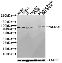 Western Blot Positive WB detected in: K562 whole cell lysate(30µg), THP-1 whole cell lysate(30µg), JK whole cell lysate(30µg), HepG2 whole cell lysate(30µg), A549 whole cell lysate(30µg), Mouse Brain tissue lysate(30µg),Rat Brain tissue lysate(30µ...