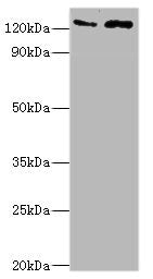 Western blot All lanes: KDM4B antibody at 4ug/ml Lane 1: Jurkat whole cell lysate Lane 2: k562 whole cell lysate Secondary Goat polyclonal to rabbit IgG at 1/10000 dilution Predicted band size: 122, 51 kDa Observed band size: 122 kDa