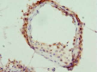 Immunohistochemistry of paraffin-embedded human testis tissue using CSB-PA012156ESR2HU at dilution of 1:100