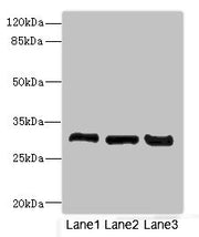 Western blot All lanes: KHKantibody at 3.6ug/ml Lane 1: Mouse liver tissue Lane 2: Mouse kidney tissue Lane 3: Rat kidney tissue Secondary Goat polyclonal to rabbit IgG at 1/10000 dilution Predicted band size: 33 kDa Observed band size: 33 kDa
