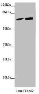 Western blot All lanes: KIAA0391 antibody at 1.06µg/ml Lane 1: LO2 whole cell lysate Lane 2: 293T whole cell lysate Secondary Goat polyclonal to rabbit IgG at 1/10000 dilution Predicted band size: 68, 66, 25, 57 kDa Observed band size: 68 kDa