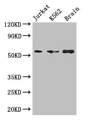 Western Blot Positive WB detected in: Jurkat whole cell lysate, K562 whole cell lysate, Mouse brain tissue All lanes: KIAA0513 antibody at 2.7µg/ml Secondary Goat polyclonal to rabbit IgG at 1/50000 dilution Predicted band size: 47, 34, 46 kDa Obs...