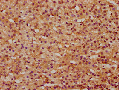 IHC image of CSB-PA012199LA01HU diluted at 1:400 and staining in paraffin-embedded human adrenal gland tissue performed on a Leica BondTM system. After dewaxing and hydration, antigen retrieval was mediated by high pressure in a citrate buffer (pH...